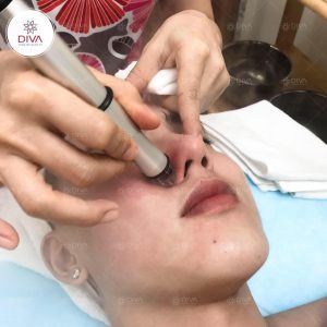 Căng tràn sức sống làn da (Face Nourishment)