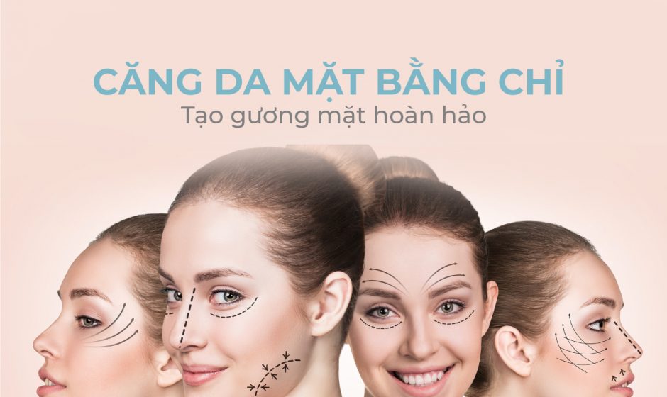 Thon gọn mặt bằng chỉ không cần phẫu thuật