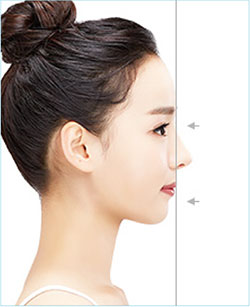tỷ lệ giữa môi trên và chân sống mũi