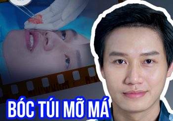 Bóc túi mỡ má có ảnh hưởng gì không?