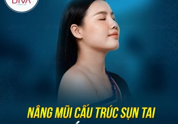 Nâng mũi cấu trúc sụn tai có tốt không?
