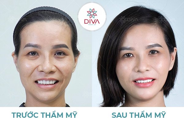 Kết quả thẩm mỹ chính là thước đo giá trị bạn nhận được