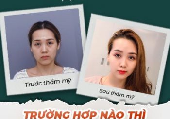 Trường hợp nào thì nhấn mí mắt?