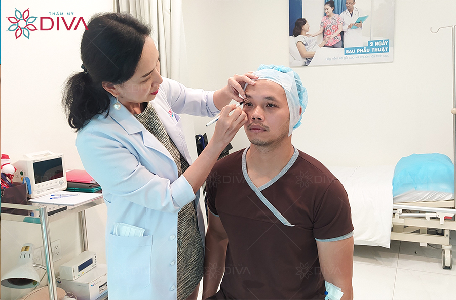 Cần đo đạc chi tiết, tỉ mỉ trước khi cắt mắt để tránh trường hợp cắt mắt bị trợn.