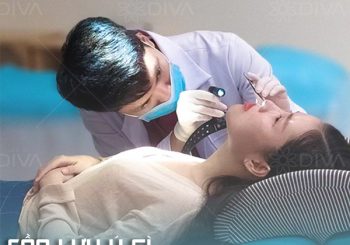 Cần lưu ý gì khi chăm sóc tại nhà sau khi nâng mũi cấu trúc