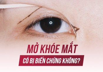 Mở khóe mắt có bị biến chứng không?