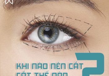 Review cắt mí mắt: khi nào nên cắt? Cắt thế nào? Cắt ở đâu?