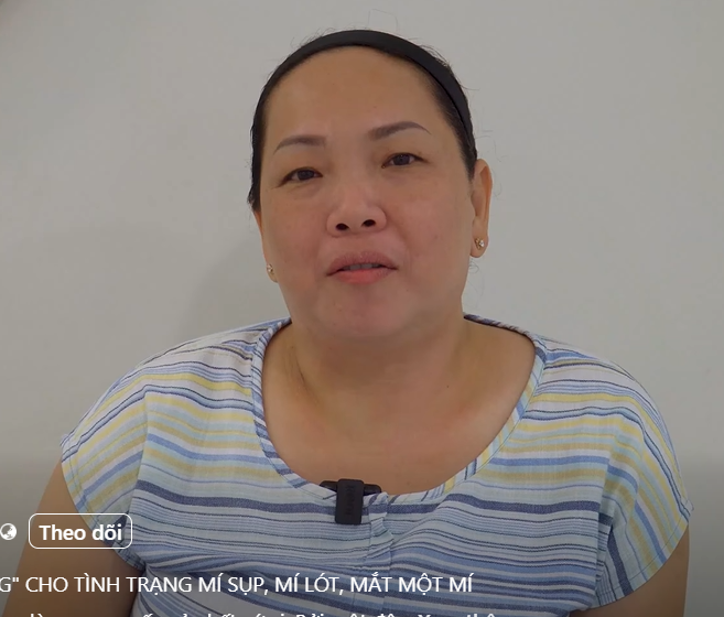 Cắt mí mắt – Giải pháp “vàng” cho tình trạng mí sụp, mí lót, mắt một mí